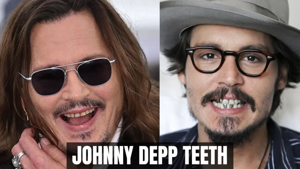 Johnny Depp Teeth