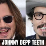 Johnny Depp Teeth